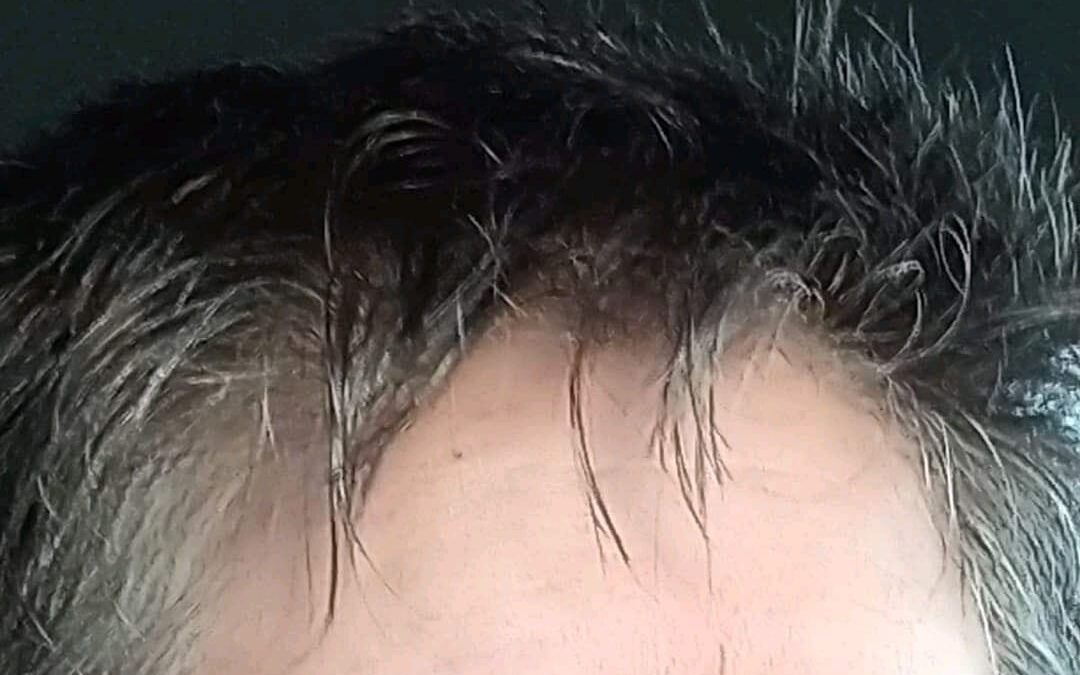 6 _ Capelli color argento ed in poco tempo l’argento predomina, tra domande e sogni realizzati ne vado fiera